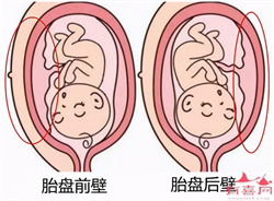 广州做试管供卵流程，如何逗宝宝开心才是最好的呢？