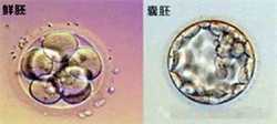 广州借卵生子的孩子是谁，输卵管不通只能做试管婴儿吗？