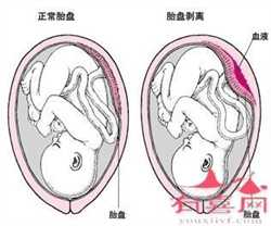 广州国内供卵~广州供卵不排队医院~，备孕二胎需要注意什么