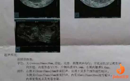 广州代生的佣金是多少,广州第三代试管婴儿医院费用多少呢？