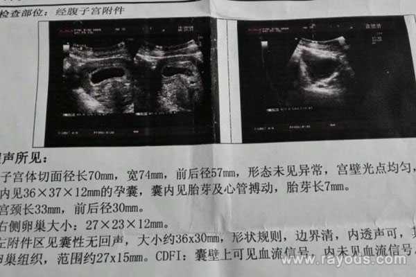 40多岁广州代生，广州试管医院_广州可以做第三代试管婴儿的医院有哪些