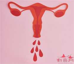 广州供卵移植，广州多囊卵巢那家医院好